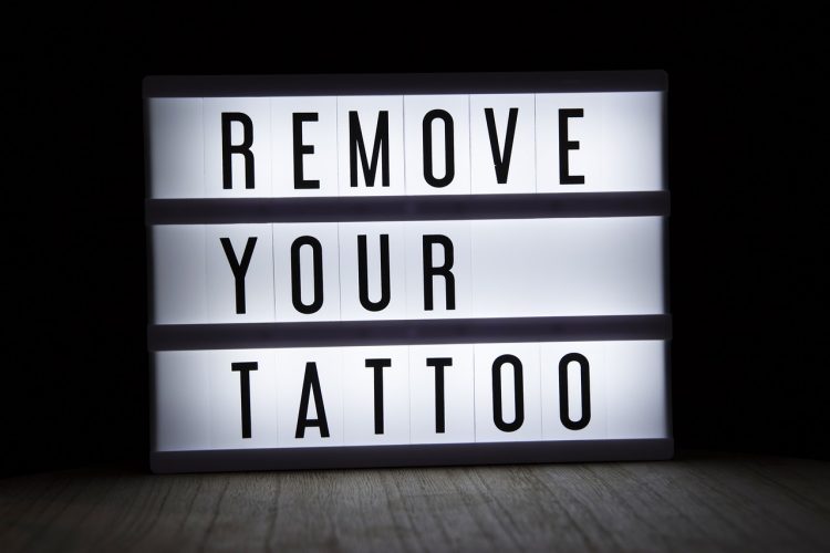 Understanding the Safety and Risks of Laser Tattoo Removal